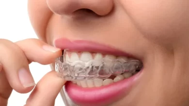 orthodontic-underbite-correction:-modern-techniques-for-a-better-smile